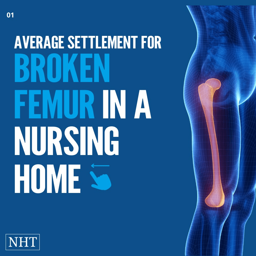 Average settlement for broken femur