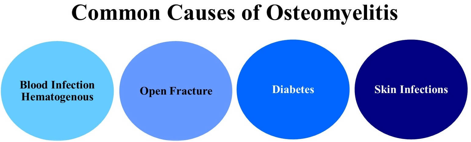 Causes of Osteomyelitis