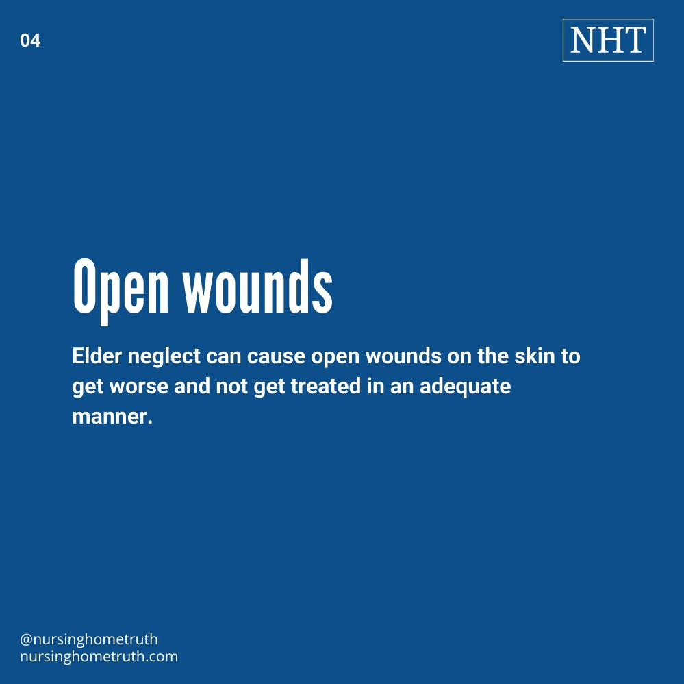 an immobile patient is most susceptible to open bed sore wounds