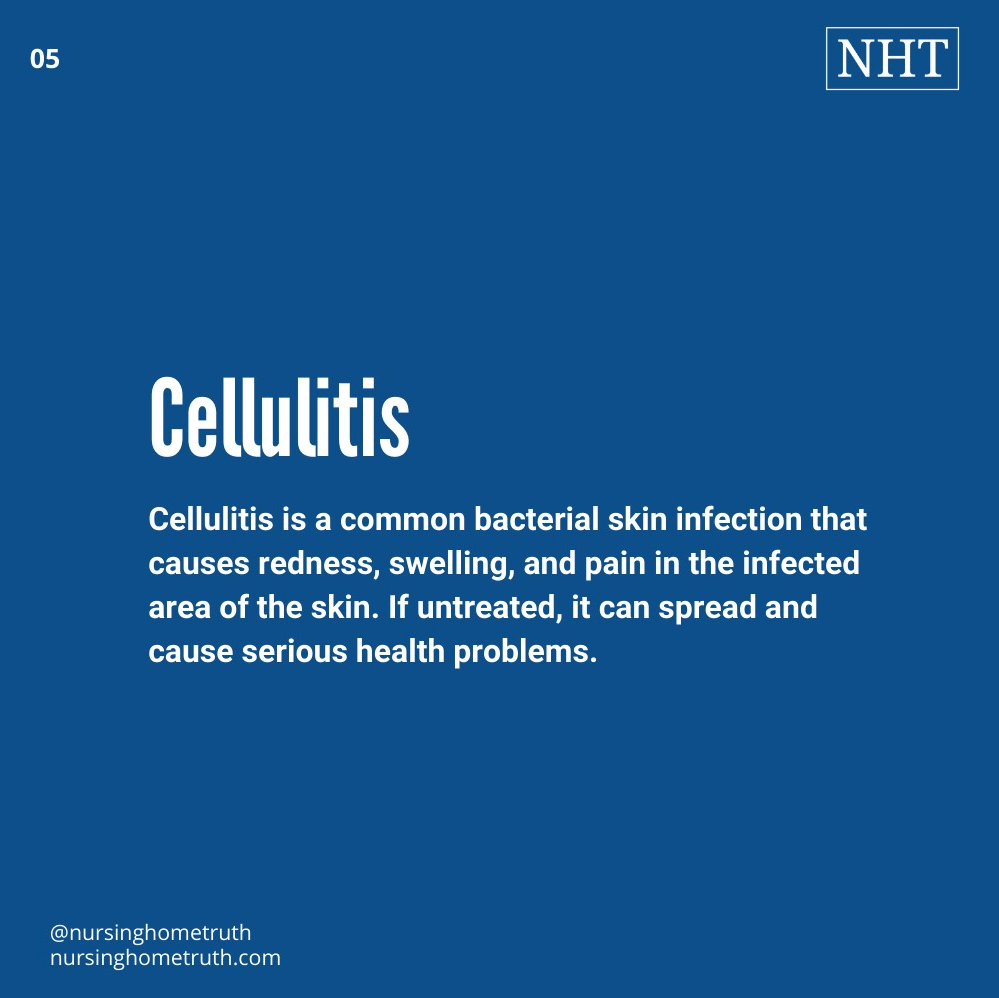 an immobile patient is susceptible to cellulitis