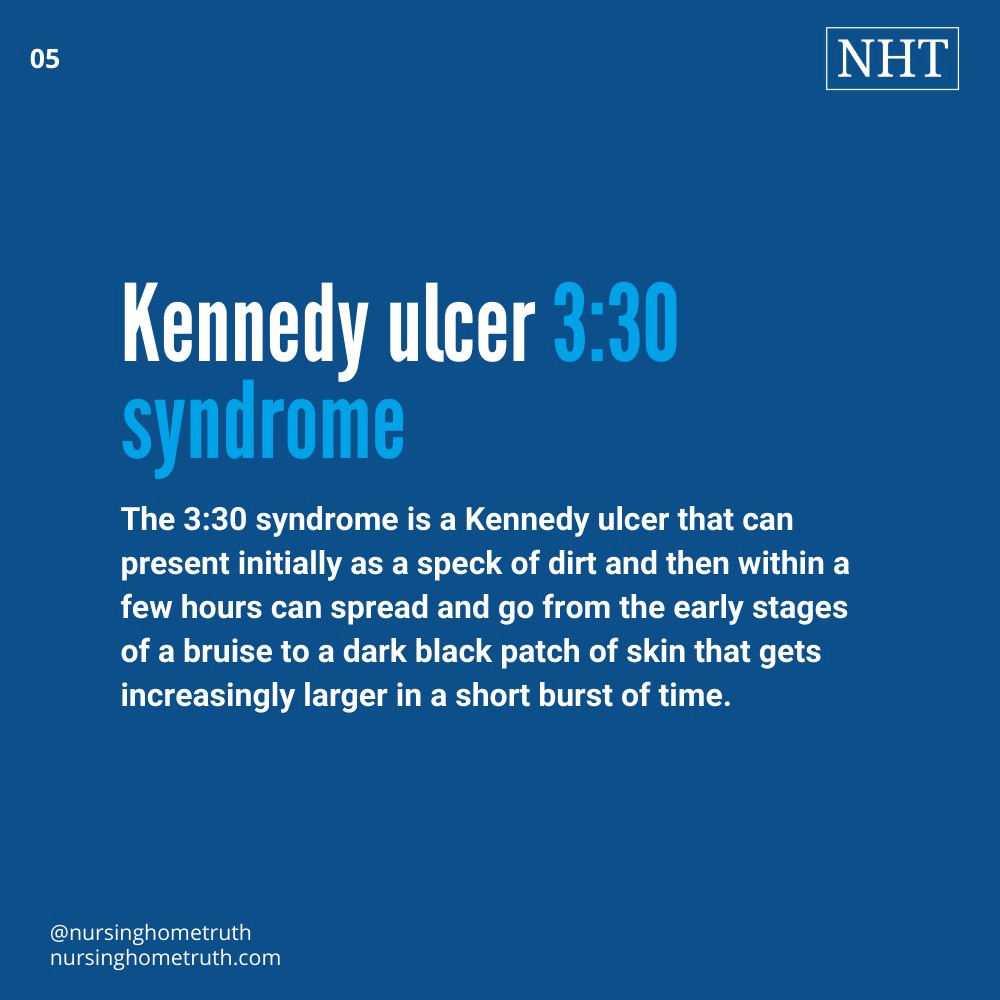 kennedy ulcer 3:30 syndrome